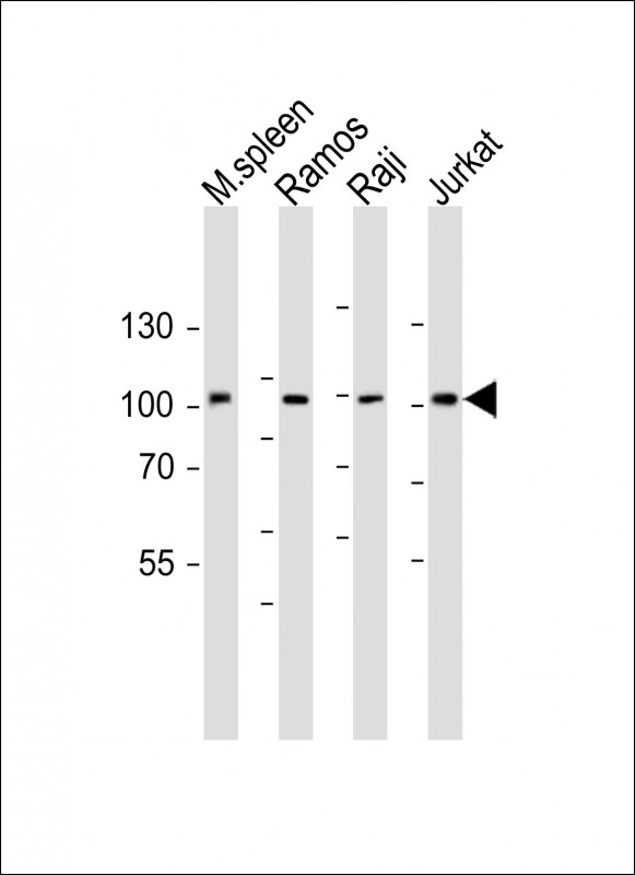 BCL6 Antibody (Center) APR04907G Leading Biology Leading Biology Inc.