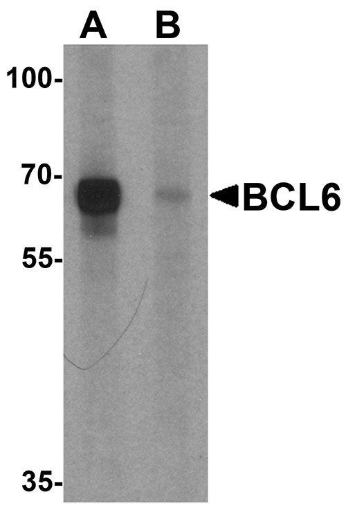 BCL6 Antibody APR06777G Leading Biology Leading Biology Inc.